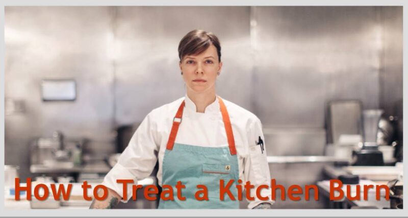 Poster illustrating how to treat a kitchen burn