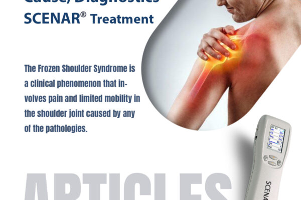 Frozen Shoulder: Cause, Diagnostics, SCENAR Treatment.