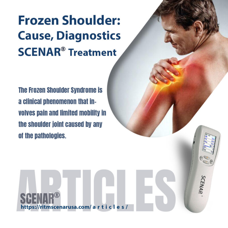 Frozen Shoulder: Cause, Diagnostics, SCENAR Treatment.