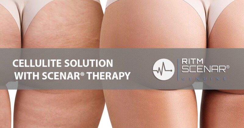 Cellulite solution with SCENAR® therapy promotional poster