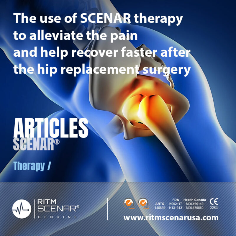 The use of SCENAR therapy to alleviate the pain and help recover faster after the hip replacement surgery