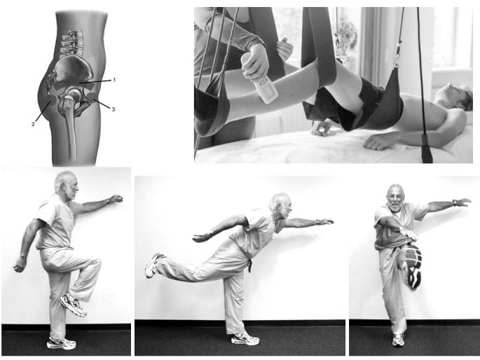 The use of SCENAR therapy to alleviate the pain and help recover faster after the hip replacement surgery