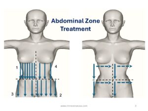 PROCEDURE 3 – GENERAL ZONE “ABDOMEN ZONE”