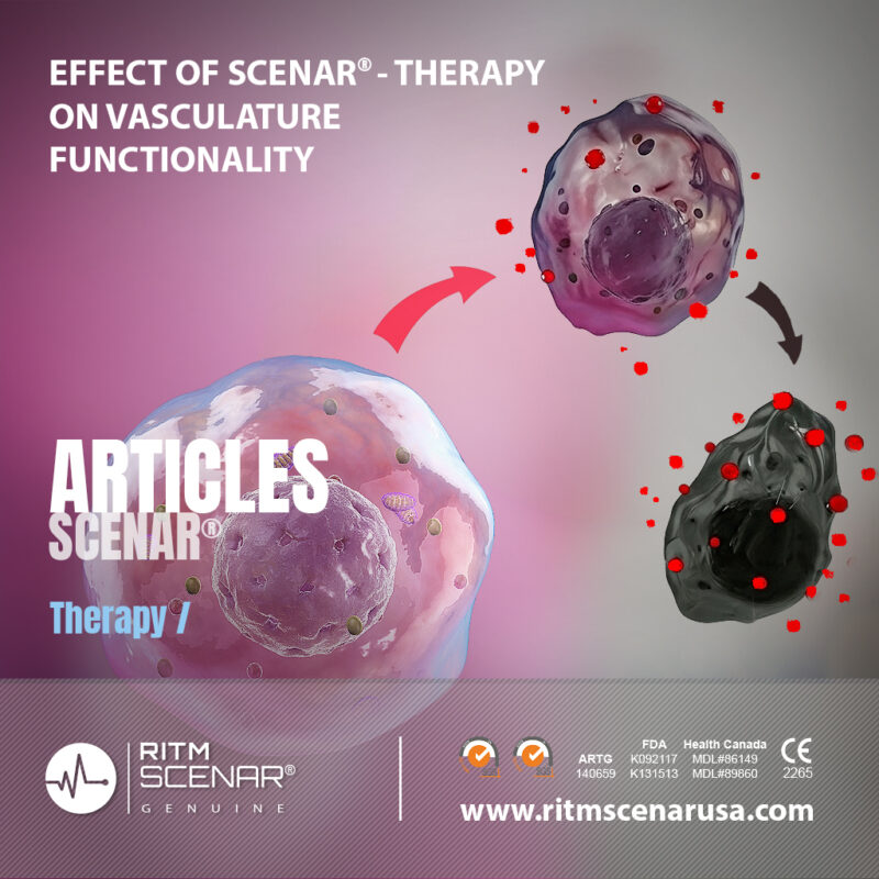 EFFECT OF SCENAR-THERAPY ON VASCULATURE FUNCTIONALITY