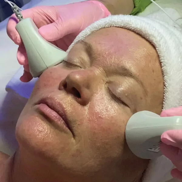 PREVENTION OF SKIN AGING USING SCENAR THERAPY