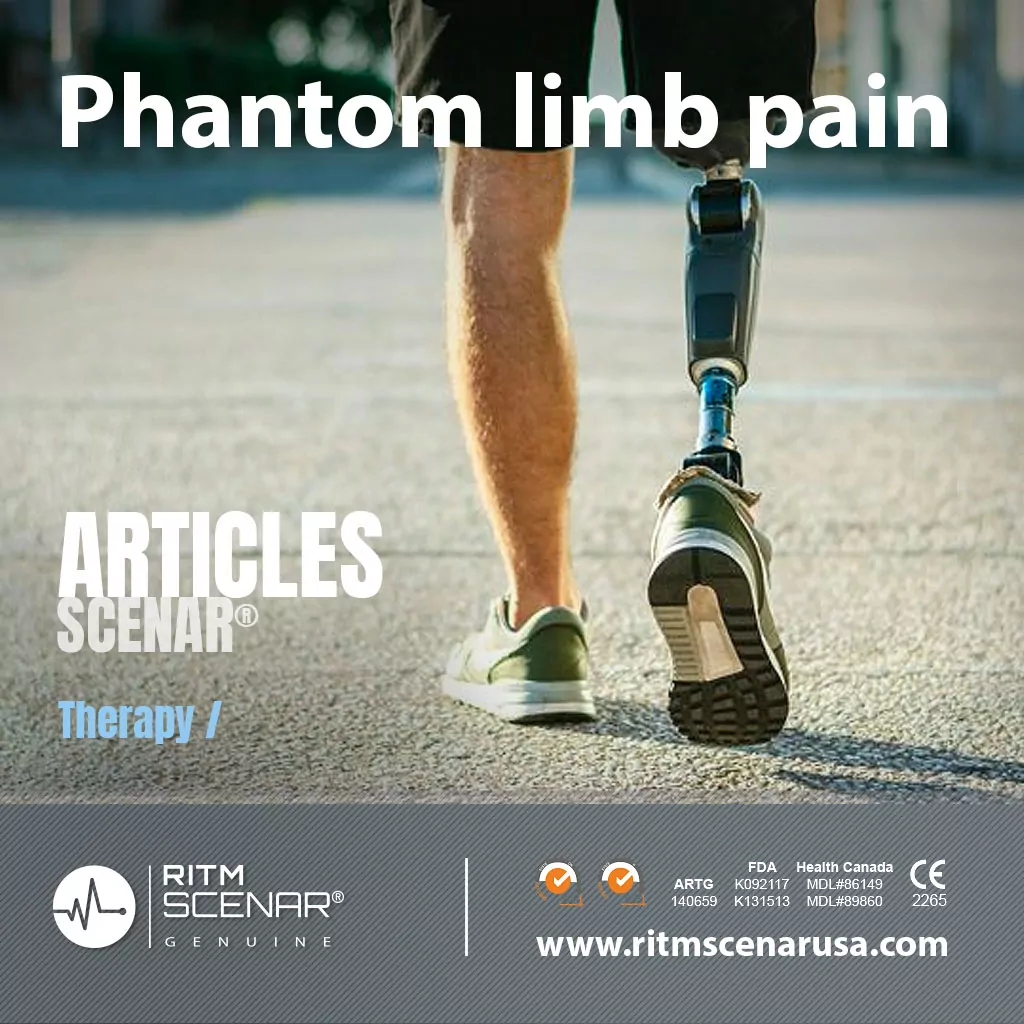 Phantom limb pain